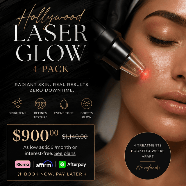 Laser Glow 4 pack at Soul Aura in Indian Orchard, MA