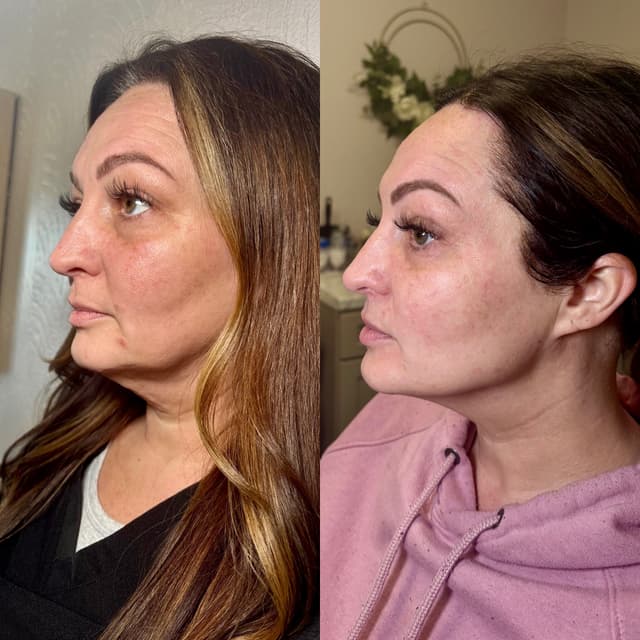 Advanced RF at Soul Aura in Indian Orchard, MA